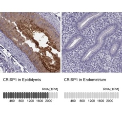 CRISP-1 Antibody, Novus Biologicals 25 &mu;L; Unlabeled:Antibodies, Polyclonal